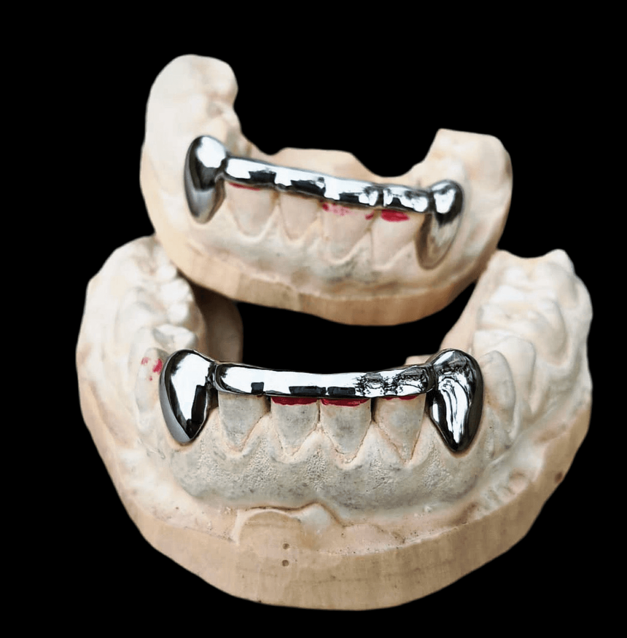Custom sterling silver grillz with fang-style design on dental molds, showcasing a polished, mirror-like finish.