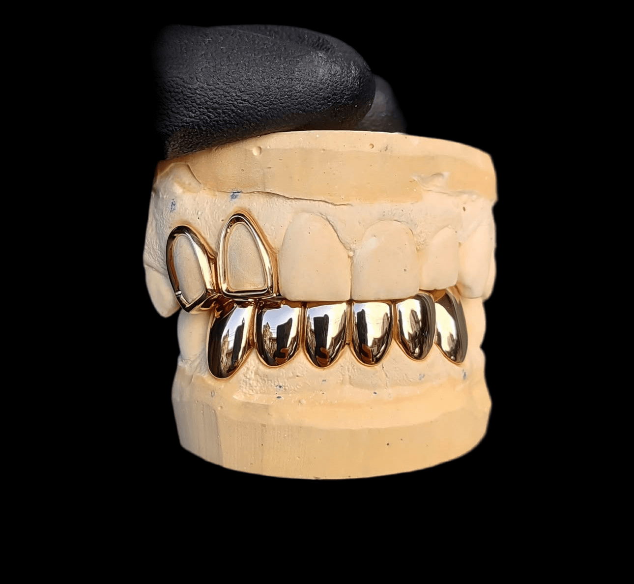 Carter Royale luxurious grillz set crafted in gold, showcasing a bold polished design on a dental mold.