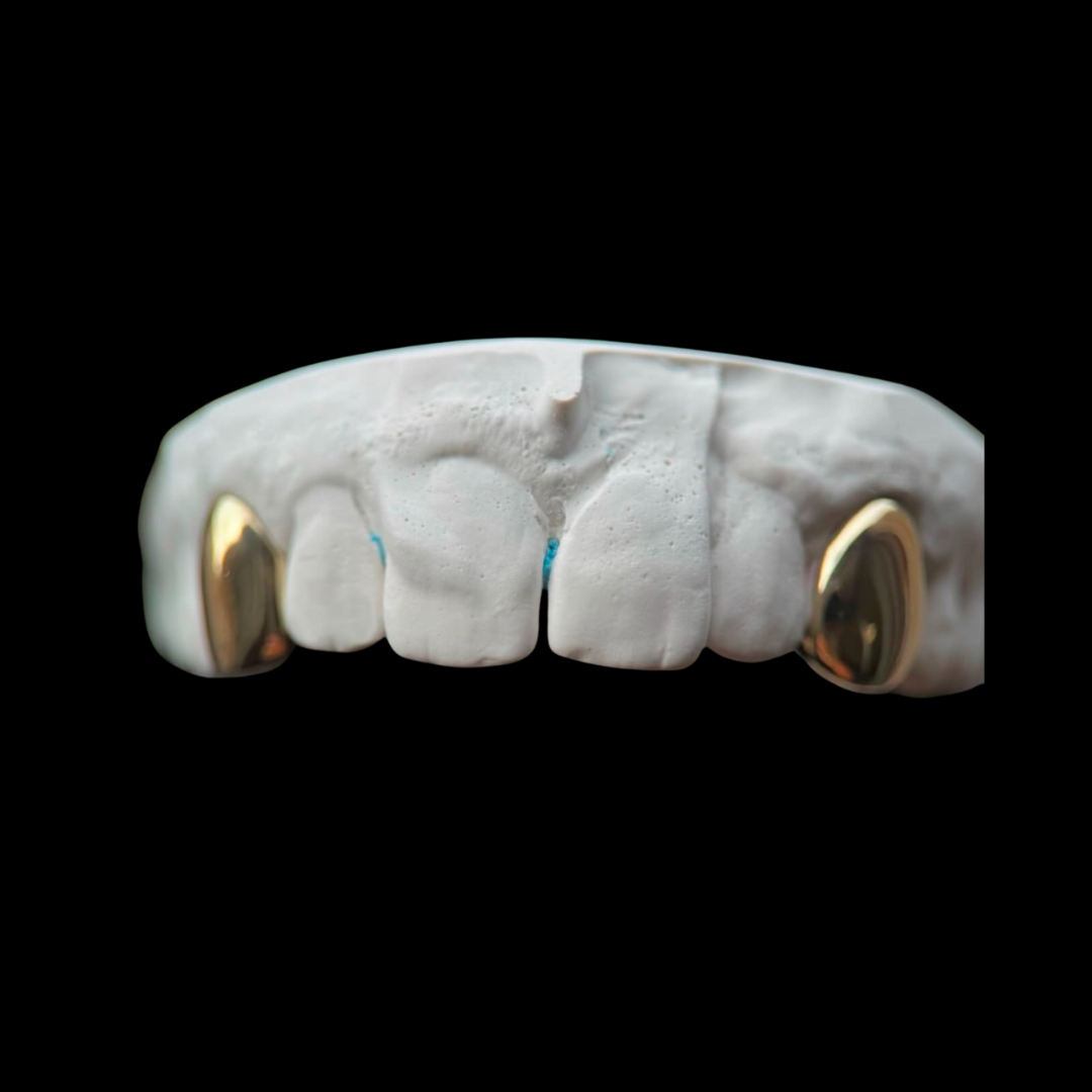 Gold Fangs