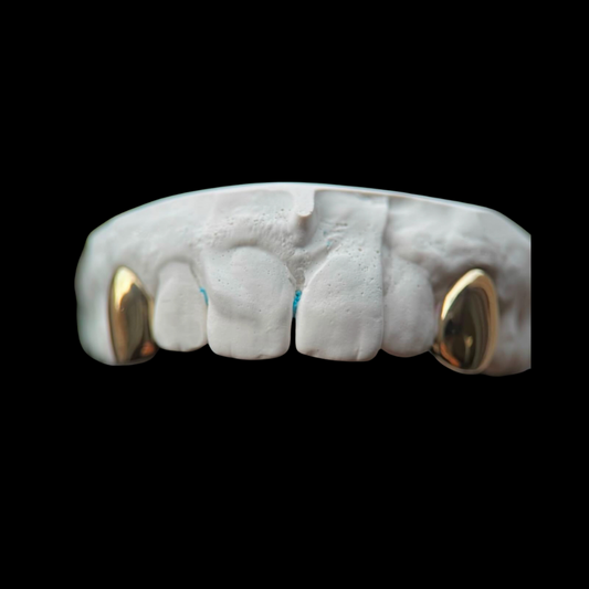 Gold Fangs
